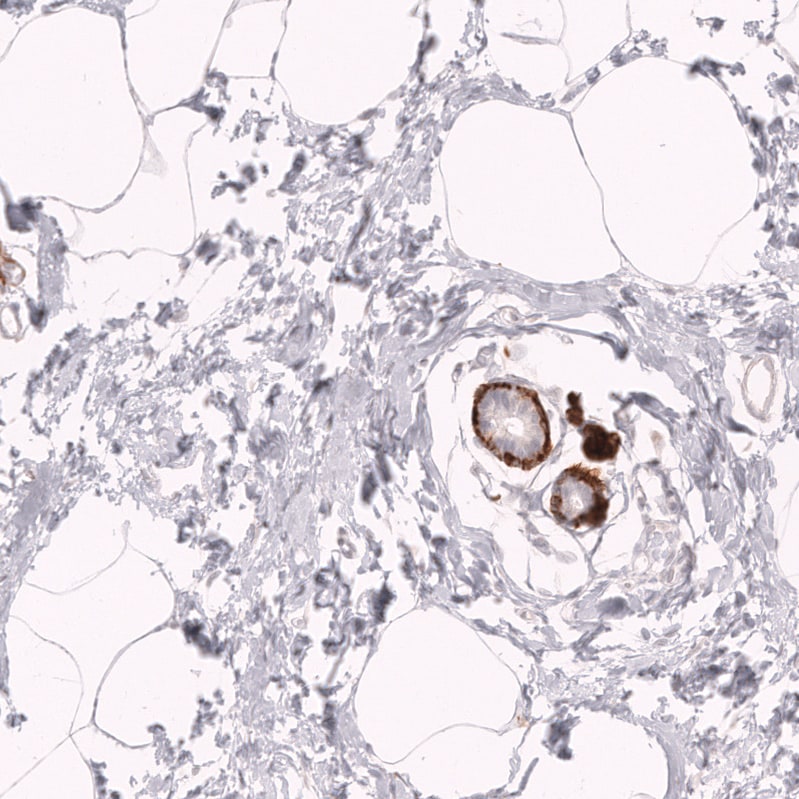 Myosin heavy chain 11 Antibody (CL14619) - Azide and BSA Free Immunohistochemistry-Paraffin: Myosin heavy chain 11 Antibody [NBP3-44141]
