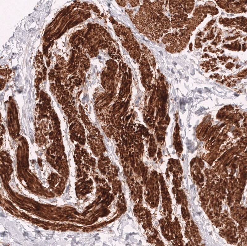 Myosin heavy chain 11 Antibody (CL14619) - Azide and BSA Free Immunohistochemistry-Paraffin: Myosin heavy chain 11 Antibody [NBP3-44141]