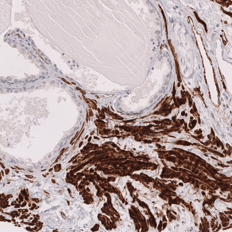 Myosin heavy chain 11 Antibody (CL14619) - Azide and BSA Free Immunohistochemistry-Paraffin: Myosin heavy chain 11 Antibody [NBP3-44141]