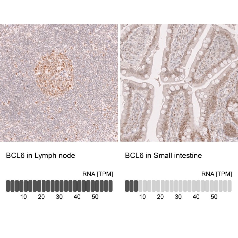 Bcl-6 Antibody (CL14611) - Azide and BSA Free Immunohistochemistry-Paraffin: Bcl-6 Antibody [NBP3-44142]