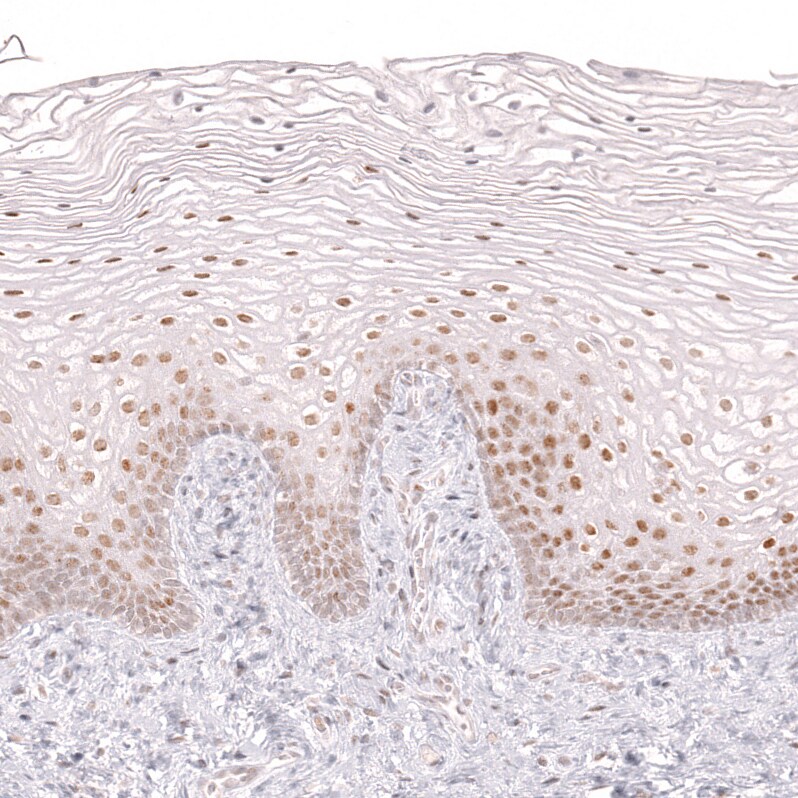 Bcl-6 Antibody (CL14611) - Azide and BSA Free Immunohistochemistry-Paraffin: Bcl-6 Antibody [NBP3-44142]