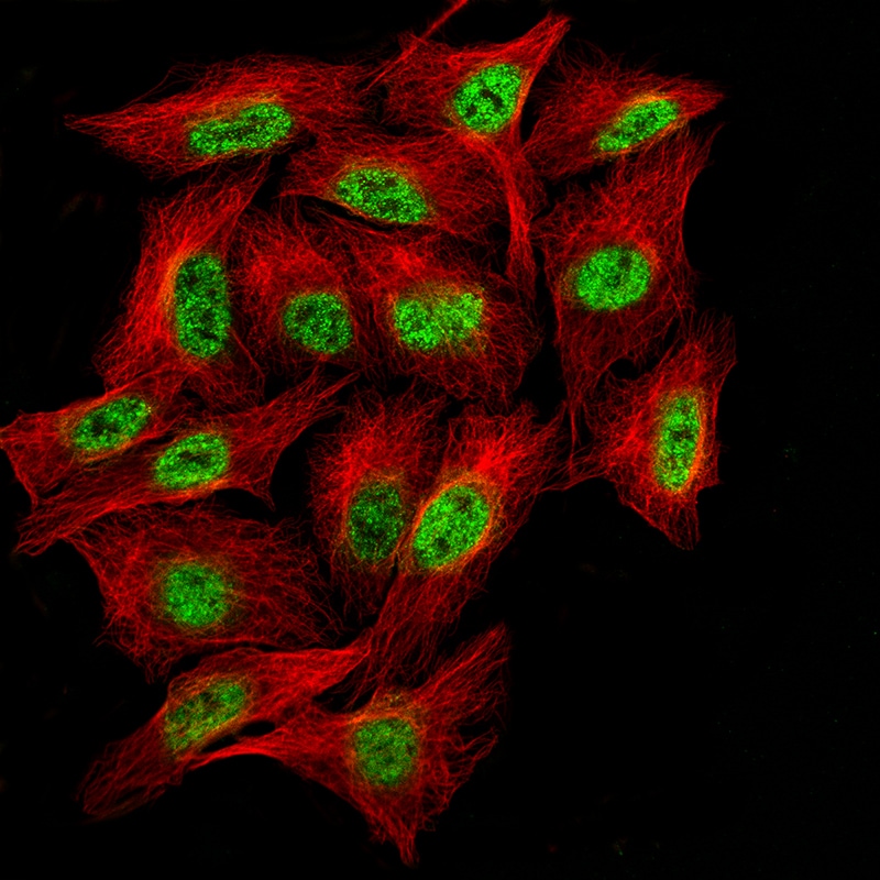 Bcl-6 Antibody (CL14611) - Azide and BSA Free Immunocytochemistry/ Immunofluorescence: Bcl-6 Antibody [NBP3-44142]