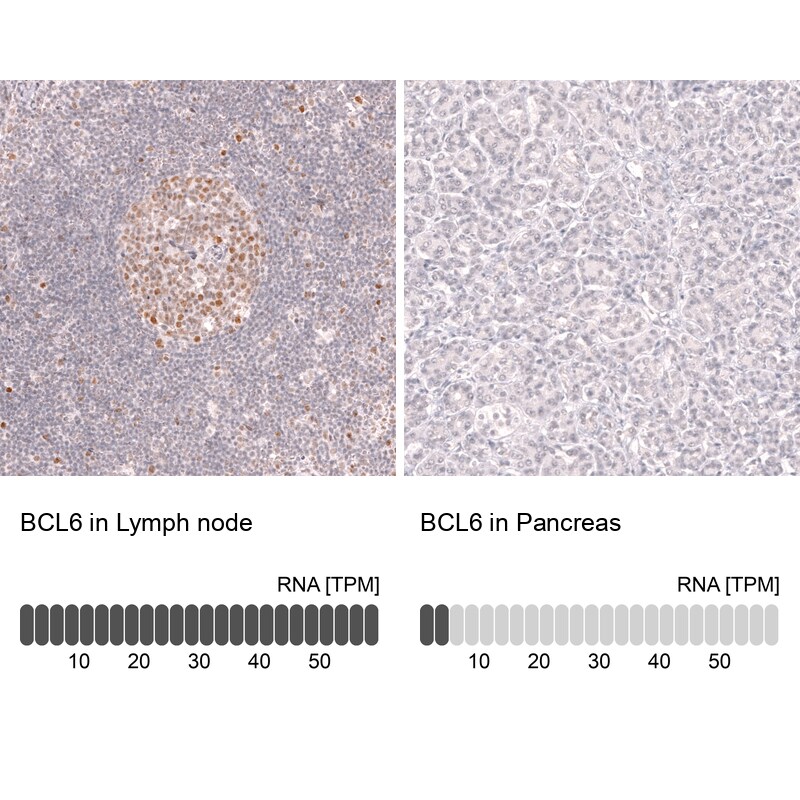 Bcl-6 Antibody (CL14612) - Azide and BSA Free Immunohistochemistry-Paraffin: Bcl-6 Antibody [NBP3-44143]