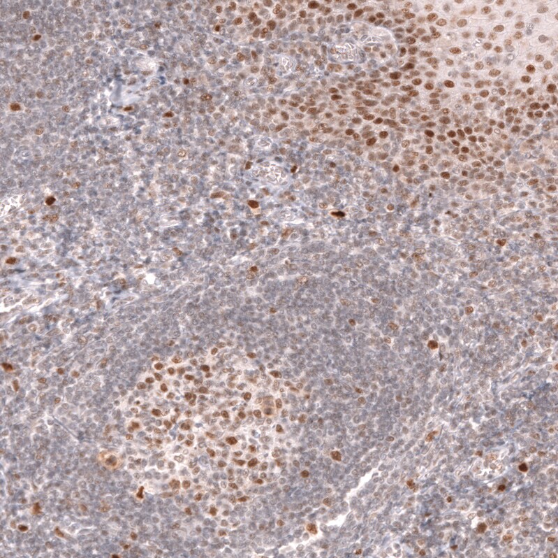 Bcl-6 Antibody (CL14612) - Azide and BSA Free Immunohistochemistry-Paraffin: Bcl-6 Antibody [NBP3-44143]