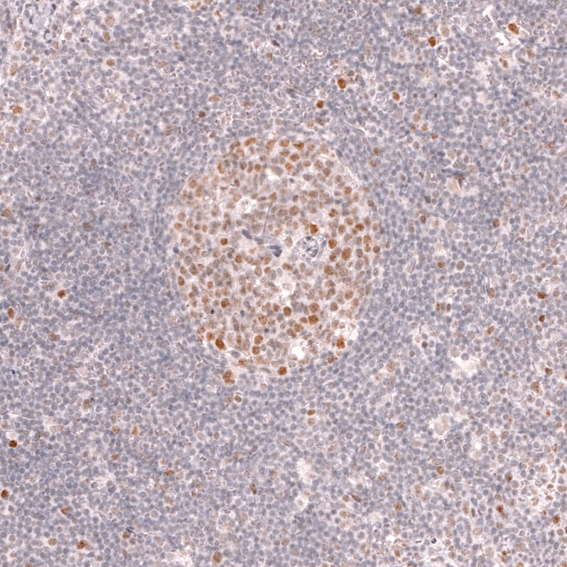 Bcl-6 Antibody (CL14612) - Azide and BSA Free Immunohistochemistry-Paraffin: Bcl-6 Antibody [NBP3-44143]