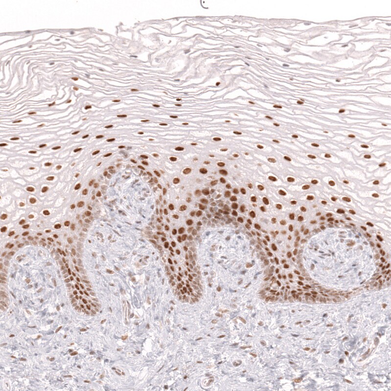 Bcl-6 Antibody (CL14612) - Azide and BSA Free Immunohistochemistry-Paraffin: Bcl-6 Antibody [NBP3-44143]