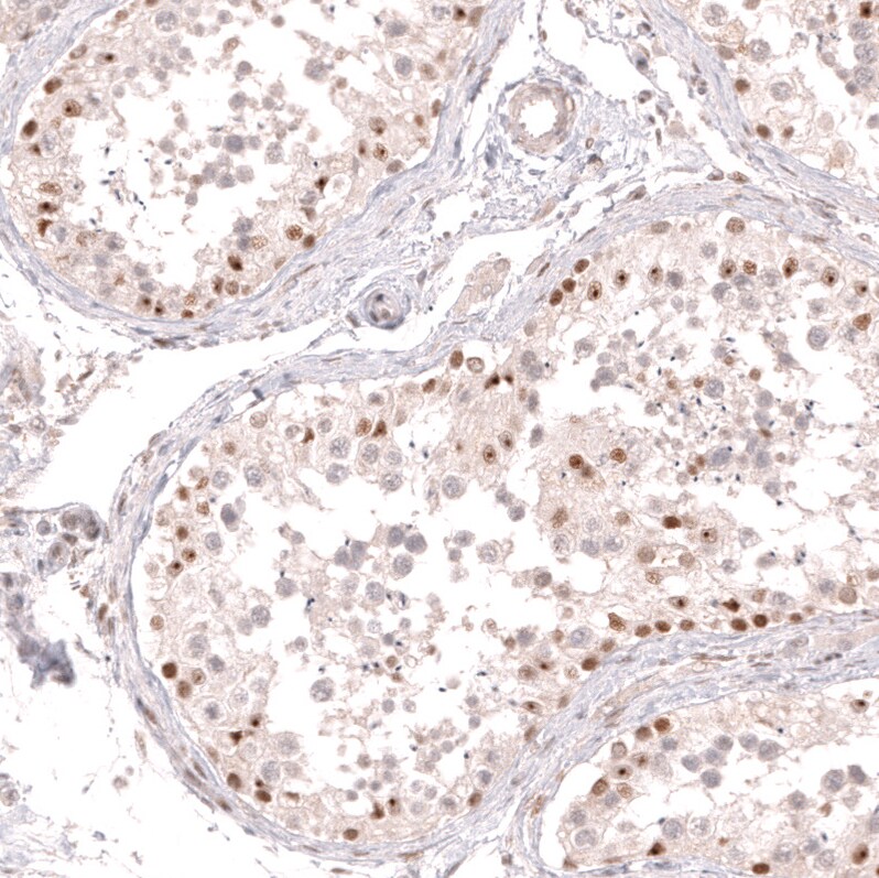 Bcl-6 Antibody (CL14612) - Azide and BSA Free Immunohistochemistry-Paraffin: Bcl-6 Antibody [NBP3-44143]