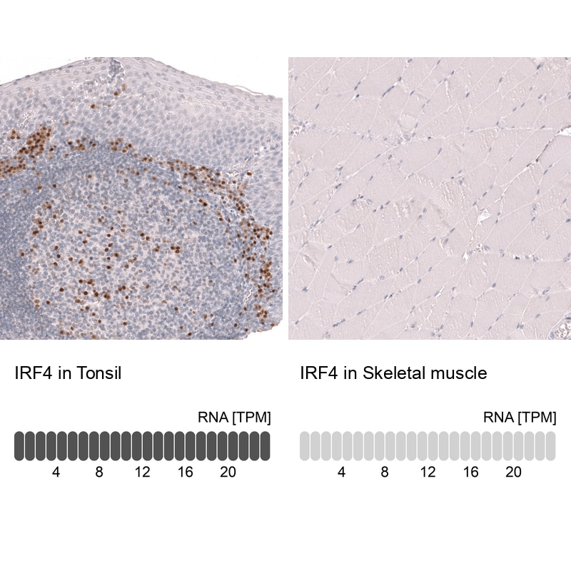 IRF4 Antibody (CL14615) - Azide and BSA Free Immunohistochemistry-Paraffin: IRF4 Antibody [NBP3-44146]