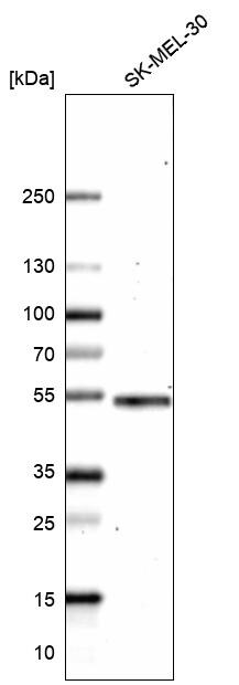 IRF4 Antibody (CL14615) - Azide and BSA Free Western Blot: IRF4 Antibody [NBP3-44146]