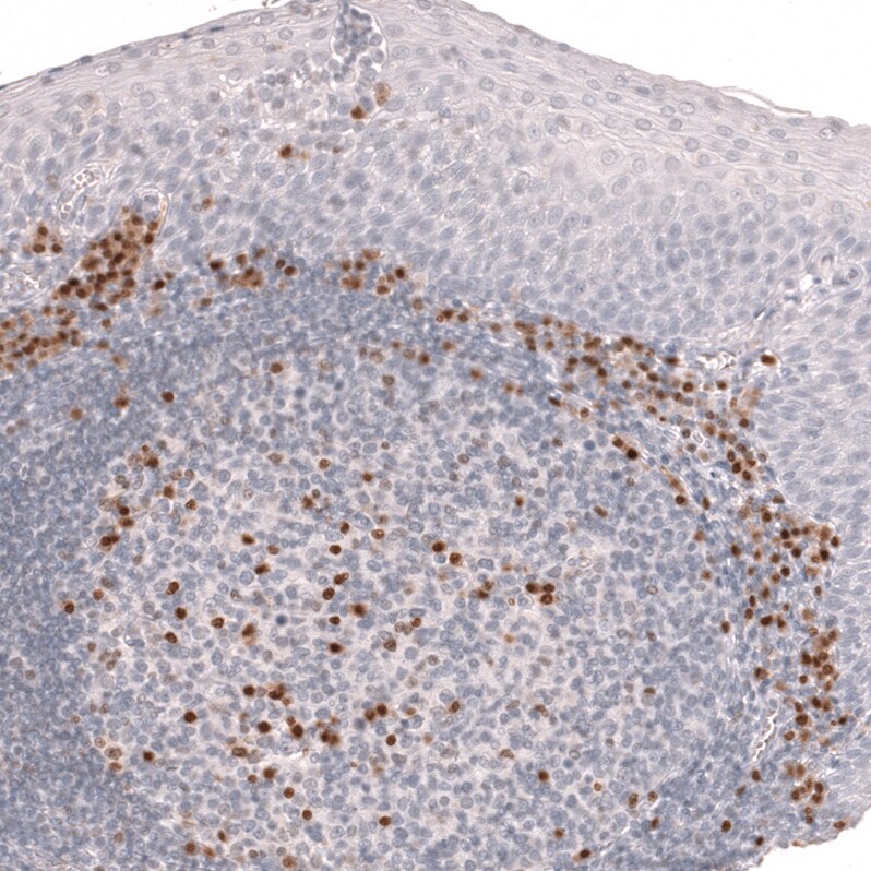 IRF4 Antibody (CL14615) - Azide and BSA Free Immunohistochemistry-Paraffin: IRF4 Antibody [NBP3-44146]
