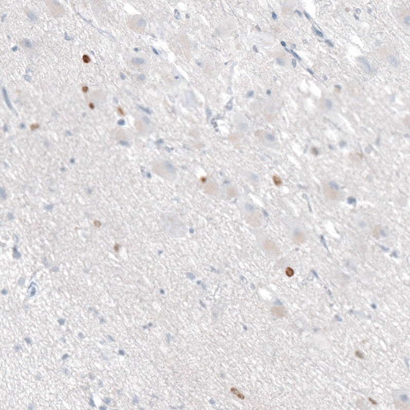 OTP Antibody (CL11222) - Azide and BSA Free Immunohistochemistry-Paraffin: OTP Antibody [NBP3-44147]