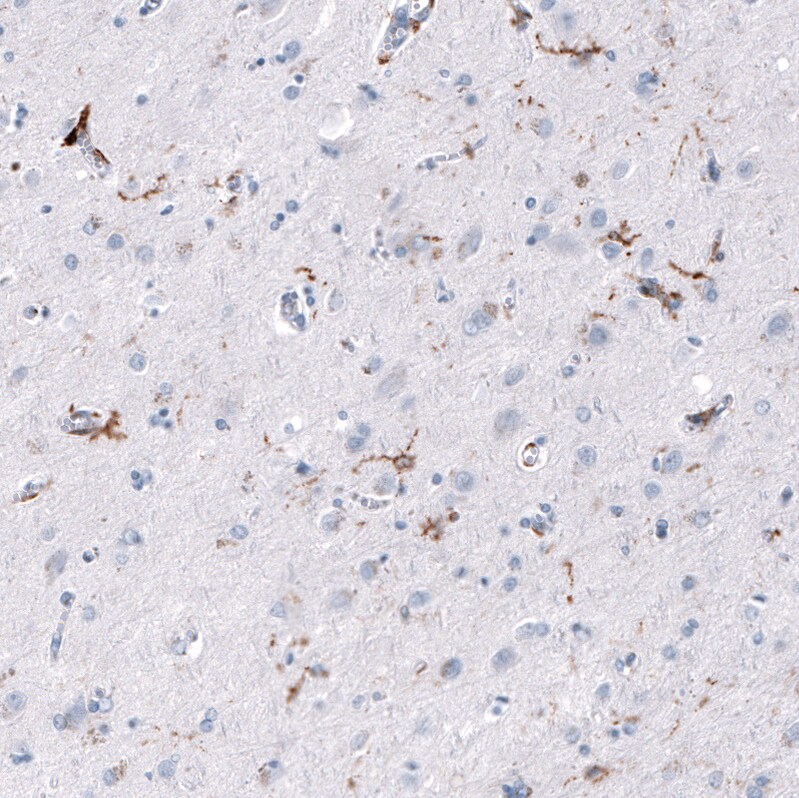 CD163 Antibody (CL10658) - Azide and BSA Free Immunohistochemistry-Paraffin: CD163 Antibody [NBP3-44148]