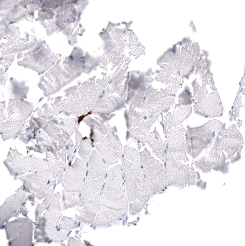 CD163 Antibody (CL10658) - Azide and BSA Free Immunohistochemistry-Paraffin: CD163 Antibody [NBP3-44148]