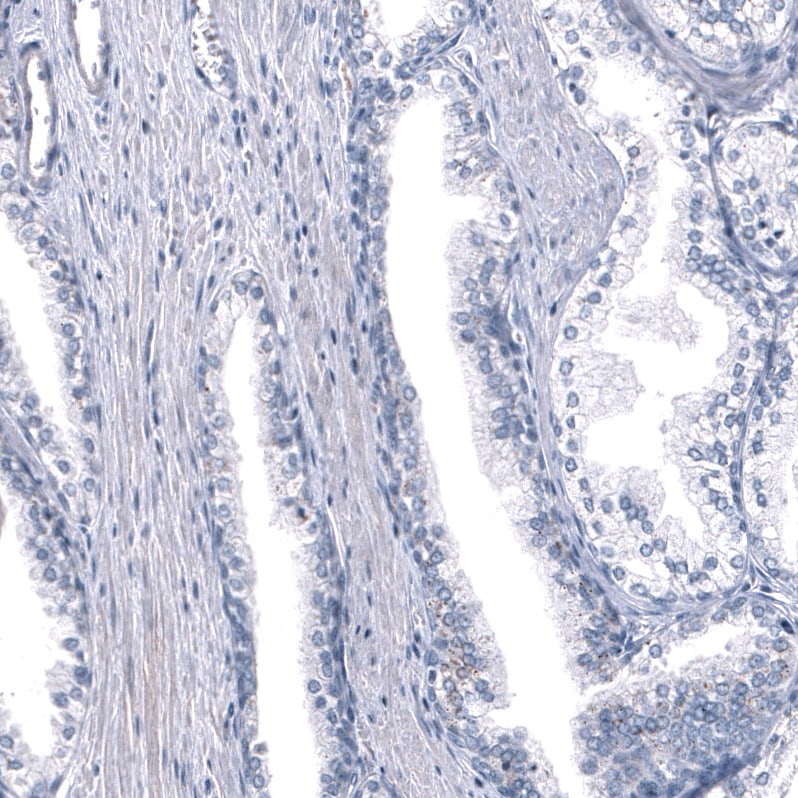GPR97 Antibody (CL11474) - Azide and BSA Free Immunohistochemistry-Paraffin: GPR97 Antibody [NBP3-44149]