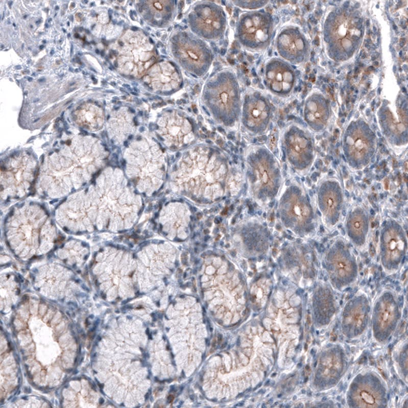 GPR97 Antibody (CL11474) - Azide and BSA Free Immunohistochemistry-Paraffin: GPR97 Antibody [NBP3-44149]