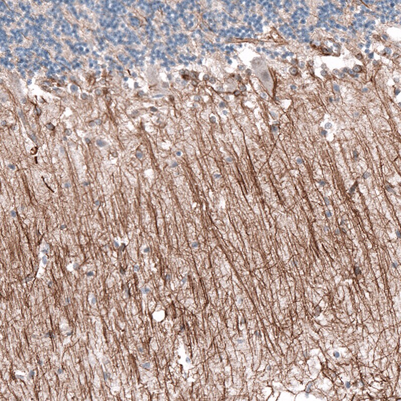P2X7/P2RX7 Antibody (CL11508) - Azide and BSA Free Immunohistochemistry-Paraffin: P2X7/P2RX7 Antibody [NBP3-44150]