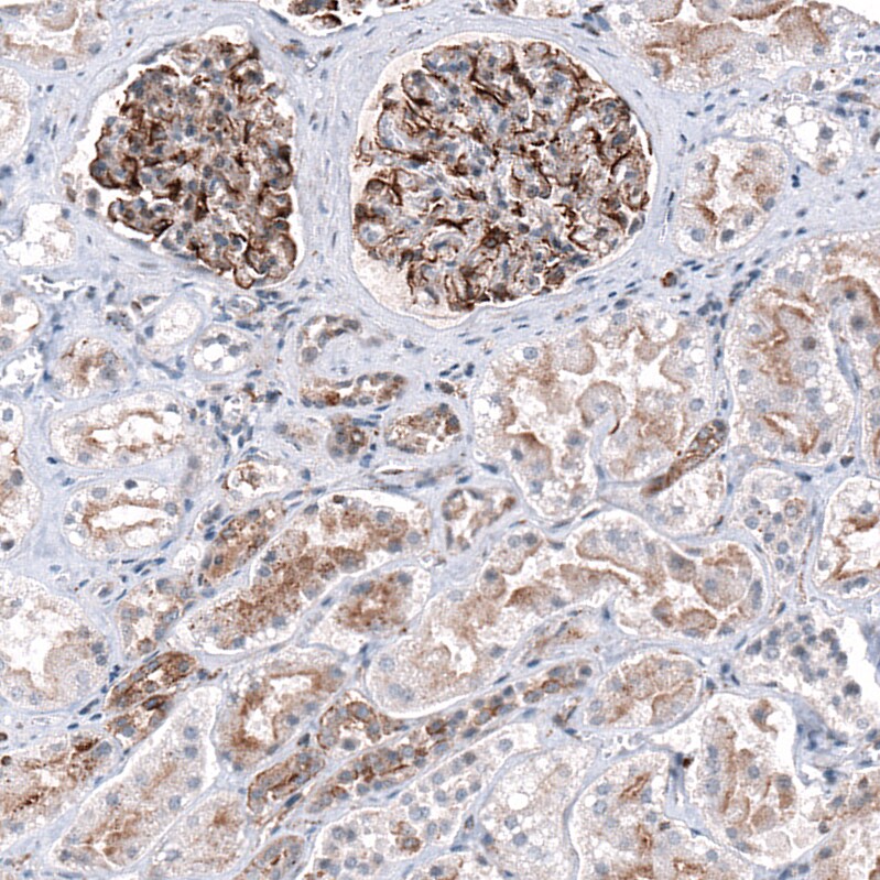 P2X7/P2RX7 Antibody (CL11508) - Azide and BSA Free Immunohistochemistry-Paraffin: P2X7/P2RX7 Antibody [NBP3-44150]