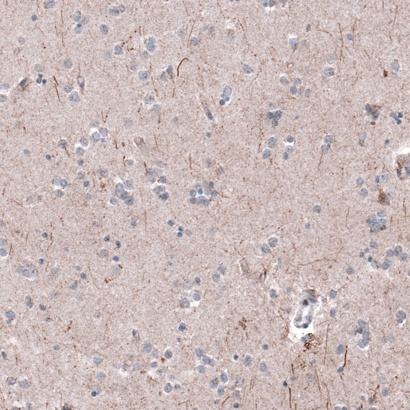 P2X7/P2RX7 Antibody (CL11508) - Azide and BSA Free Immunohistochemistry-Paraffin: P2X7/P2RX7 Antibody [NBP3-44150]