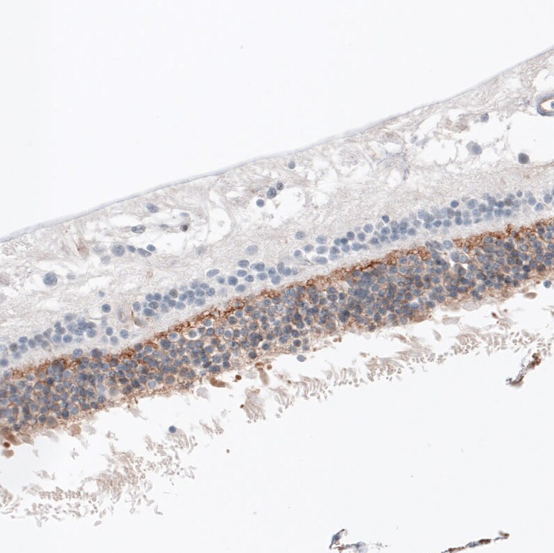 ANO2 Antibody (CL10631) - Azide and BSA Free Immunohistochemistry-Paraffin: ANO2 Antibody [NBP3-44151]