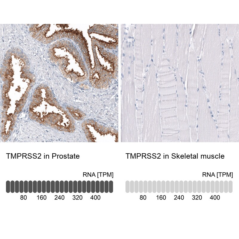 TMPRSS2 Antibody (CL12514) - Azide and BSA Free Immunohistochemistry-Paraffin: TMPRSS2 Antibody [NBP3-44152]