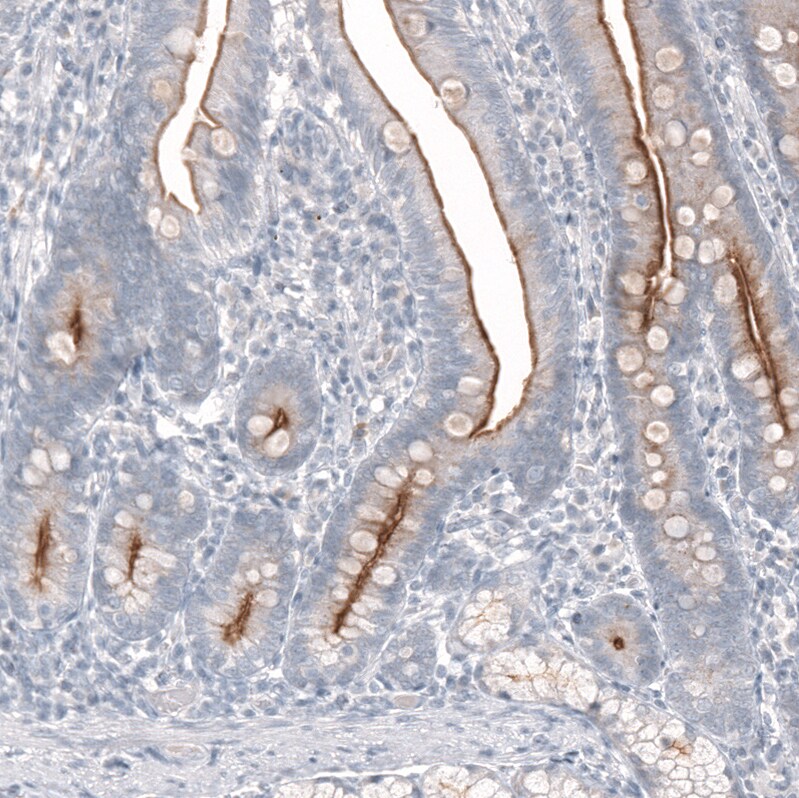 TMPRSS2 Antibody (CL12514) - Azide and BSA Free Immunohistochemistry-Paraffin: TMPRSS2 Antibody [NBP3-44152]
