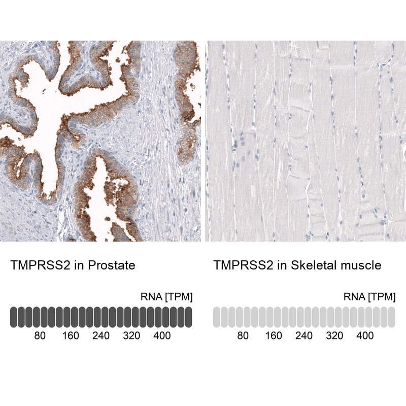 TMPRSS2 Antibody (CL12512) - Azide and BSA Free Immunohistochemistry-Paraffin: TMPRSS2 Antibody [NBP3-44153]