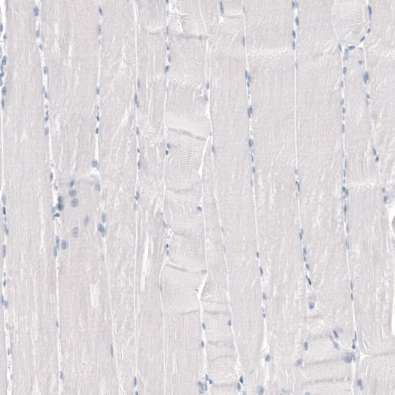 TMPRSS2 Antibody (CL12512) - Azide and BSA Free Immunohistochemistry-Paraffin: TMPRSS2 Antibody [NBP3-44153]