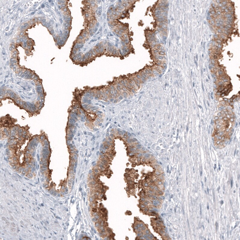 TMPRSS2 Antibody (CL12512) - Azide and BSA Free Immunohistochemistry-Paraffin: TMPRSS2 Antibody [NBP3-44153]