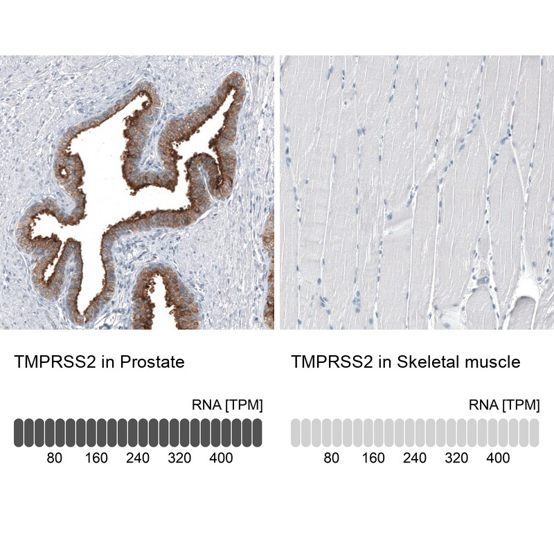 TMPRSS2 Antibody (CL12511) - Azide and BSA Free Immunohistochemistry-Paraffin: TMPRSS2 Antibody [NBP3-44154]