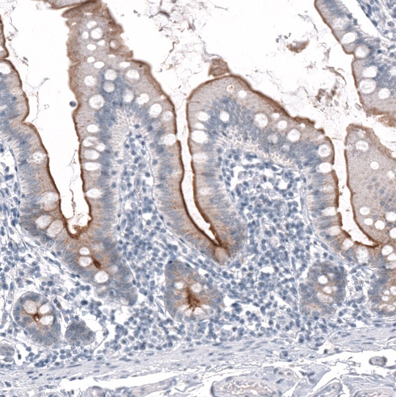TMPRSS2 Antibody (CL12511) - Azide and BSA Free Immunohistochemistry-Paraffin: TMPRSS2 Antibody [NBP3-44154]