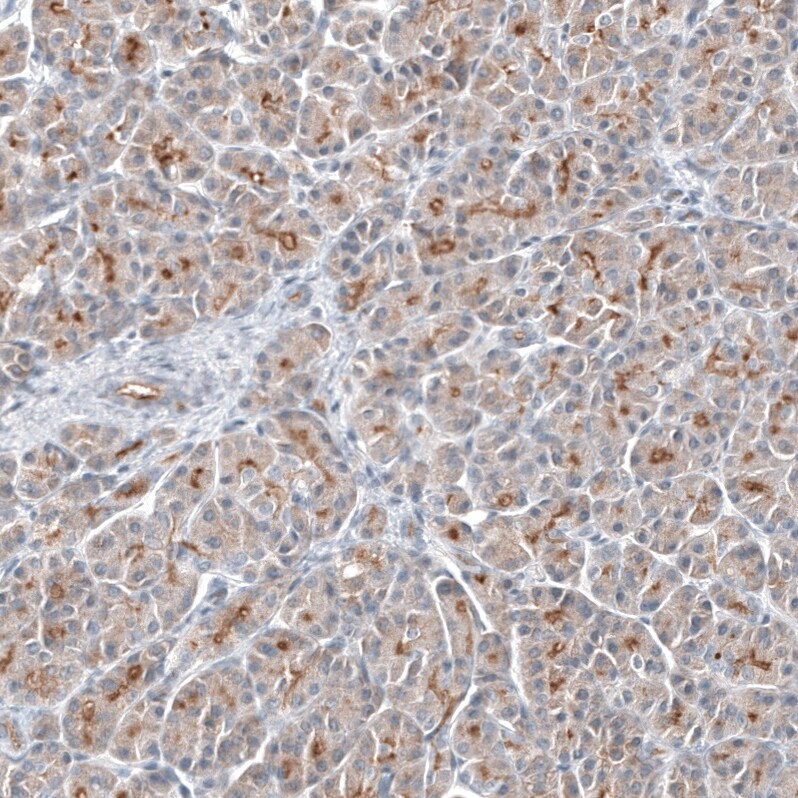 TMPRSS2 Antibody (CL12511) - Azide and BSA Free Immunohistochemistry-Paraffin: TMPRSS2 Antibody [NBP3-44154]