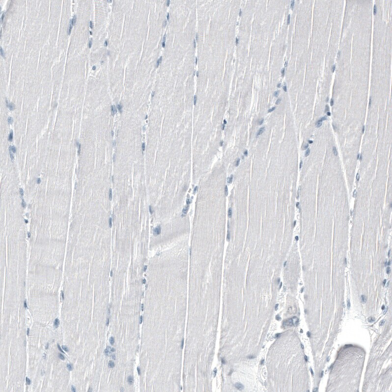 TMPRSS2 Antibody (CL12511) - Azide and BSA Free Immunohistochemistry-Paraffin: TMPRSS2 Antibody [NBP3-44154]
