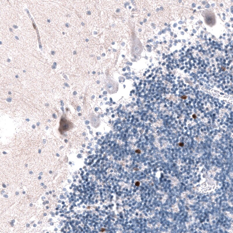 EOMES Antibody (CL15425) - Azide and BSA Free Immunohistochemistry-Paraffin: EOMES Antibody [NBP3-44155]