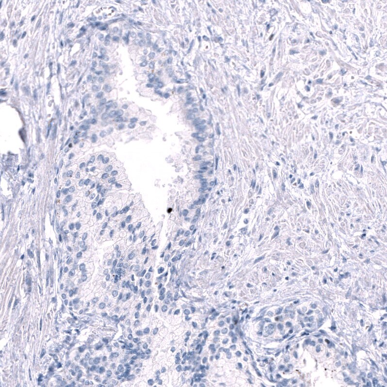 EOMES Antibody (CL15425) - Azide and BSA Free Immunohistochemistry-Paraffin: EOMES Antibody [NBP3-44155]