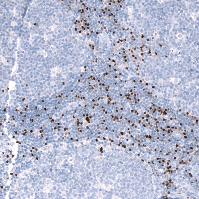 EOMES Antibody (CL15425) - Azide and BSA Free Immunohistochemistry-Paraffin: EOMES Antibody [NBP3-44155]
