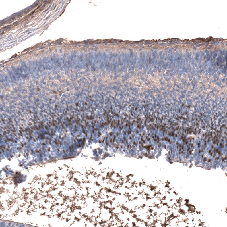 EOMES Antibody (CL15425) - Azide and BSA Free Immunohistochemistry-Paraffin: EOMES Antibody [NBP3-44155]