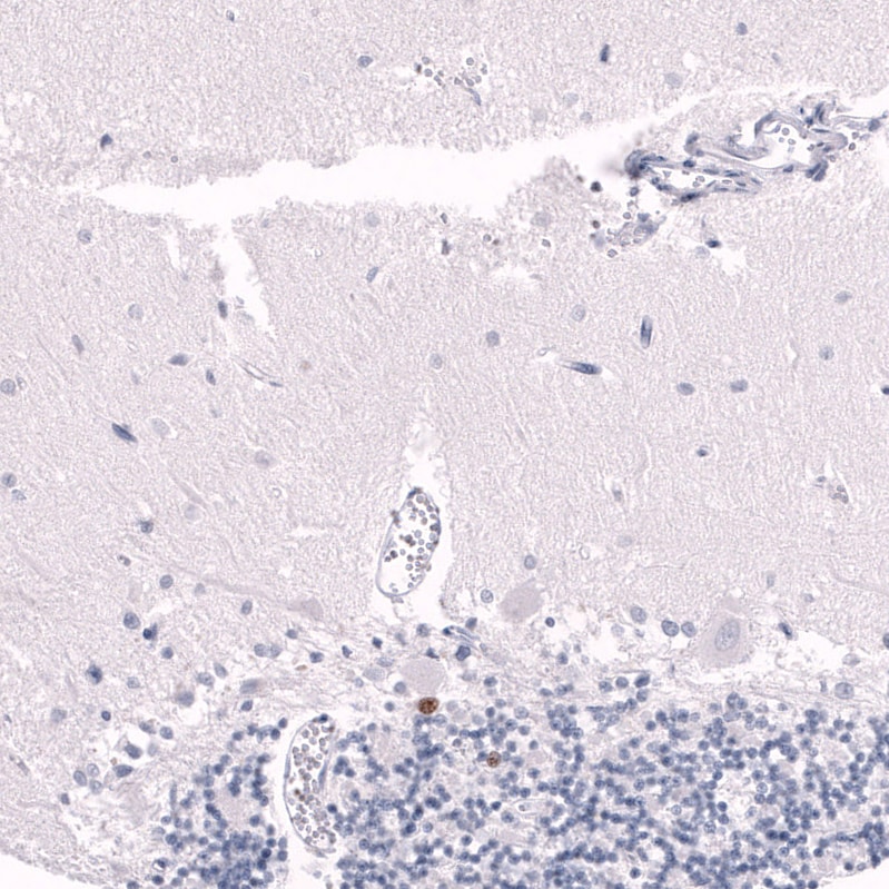 EOMES Antibody (CL15426) - Azide and BSA Free Immunohistochemistry-Paraffin: EOMES Antibody [NBP3-44156]