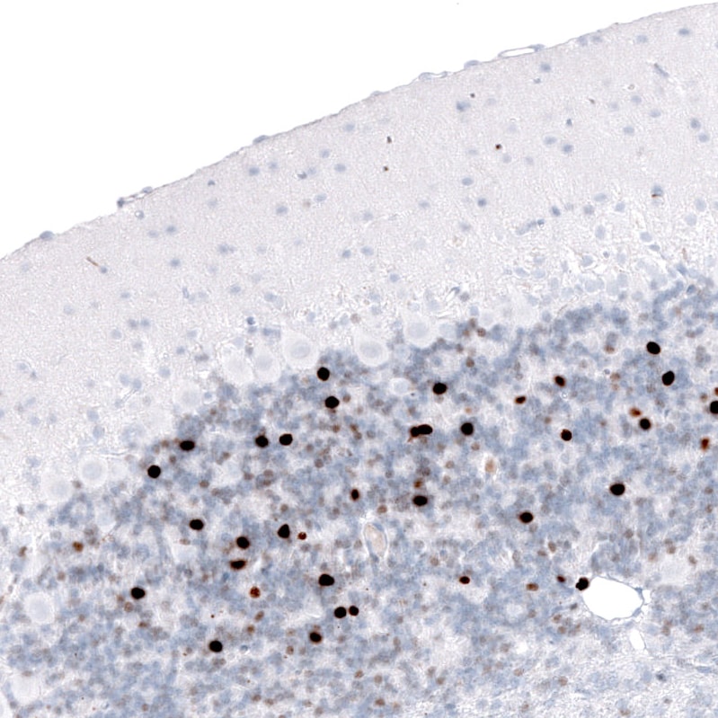 EOMES Antibody (CL15426) - Azide and BSA Free Immunohistochemistry-Paraffin: EOMES Antibody [NBP3-44156]