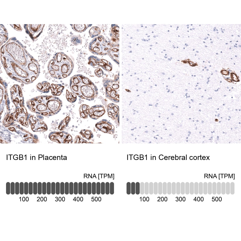 Integrin beta 1/CD29 Antibody (CL15606) - Azide and BSA Free Immunohistochemistry-Paraffin: Integrin beta 1/CD29 Antibody [NBP3-44157]