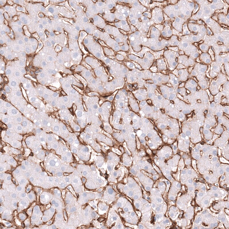 Integrin beta 1/CD29 Antibody (CL15606) - Azide and BSA Free Immunohistochemistry-Paraffin: Integrin beta 1/CD29 Antibody [NBP3-44157]