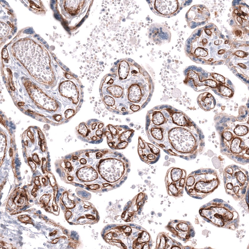 Integrin beta 1/CD29 Antibody (CL15606) - Azide and BSA Free Immunohistochemistry-Paraffin: Integrin beta 1/CD29 Antibody [NBP3-44157]