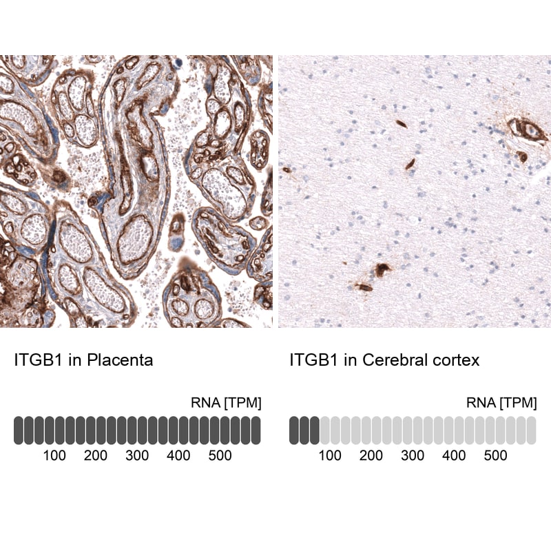 Integrin beta 1/CD29 Antibody (CL15622) - Azide and BSA Free Immunohistochemistry-Paraffin: Integrin beta 1/CD29 Antibody [NBP3-44158]