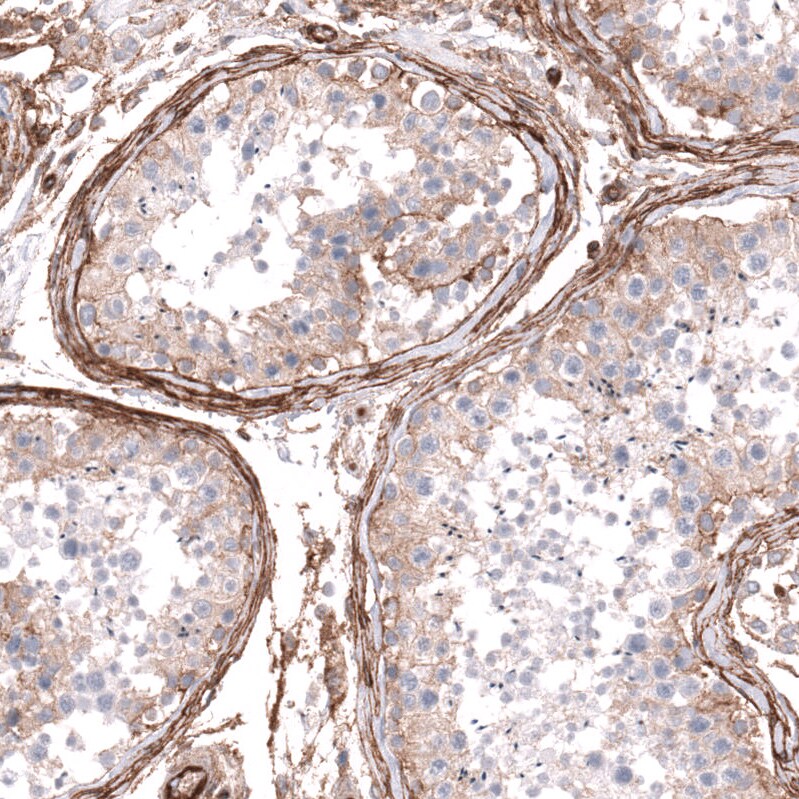 Integrin beta 1/CD29 Antibody (CL15622) - Azide and BSA Free Immunohistochemistry-Paraffin: Integrin beta 1/CD29 Antibody [NBP3-44158]