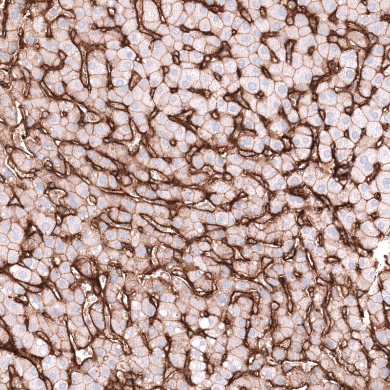 Integrin beta 1/CD29 Antibody (CL15622) - Azide and BSA Free Immunohistochemistry-Paraffin: Integrin beta 1/CD29 Antibody [NBP3-44158]