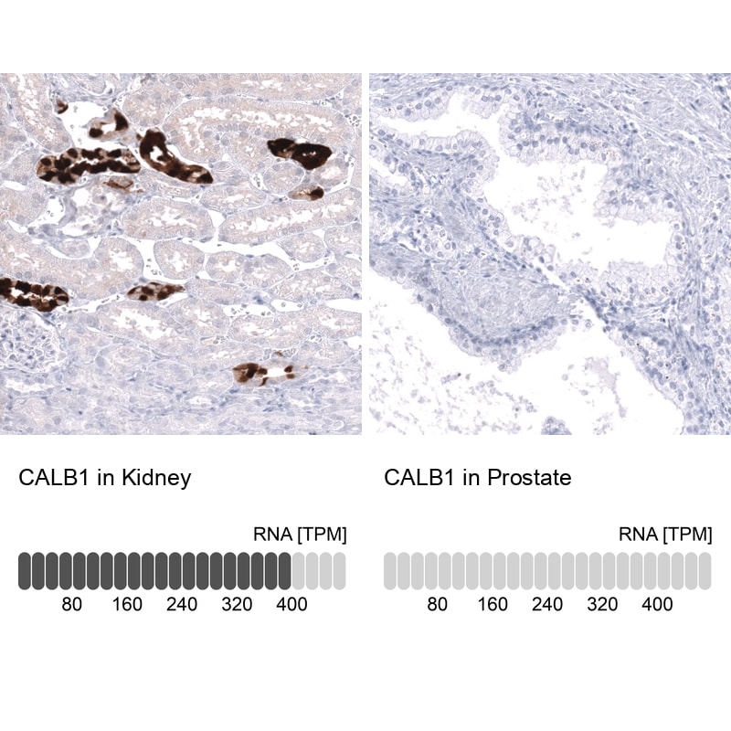 Calbindin D-28K Antibody (CL15060) - Azide and BSA Free Immunohistochemistry-Paraffin: Calbindin D-28K Antibody [NBP3-44159]