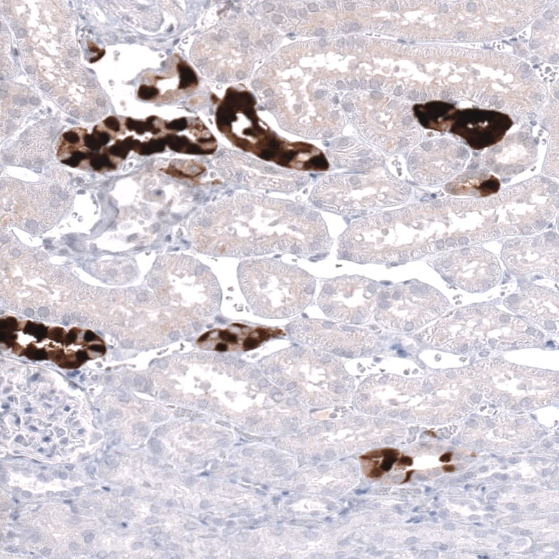 Calbindin D-28K Antibody (CL15060) - Azide and BSA Free Immunohistochemistry-Paraffin: Calbindin D-28K Antibody [NBP3-44159]