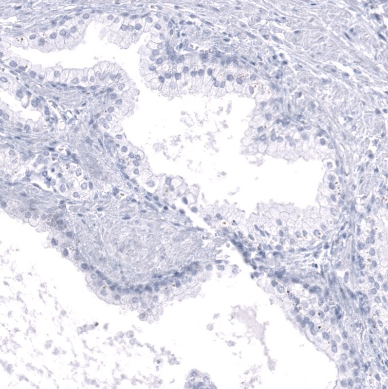 Calbindin D-28K Antibody (CL15060) - Azide and BSA Free Immunohistochemistry-Paraffin: Calbindin D-28K Antibody [NBP3-44159]