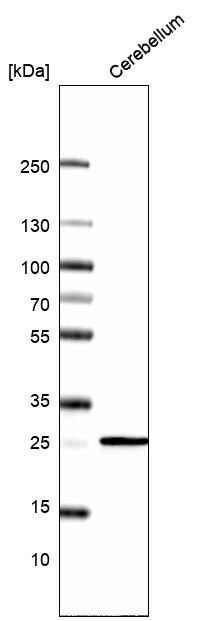 Calbindin D-28K Antibody (CL15060) - Azide and BSA Free Western Blot: Calbindin D-28K Antibody [NBP3-44159]