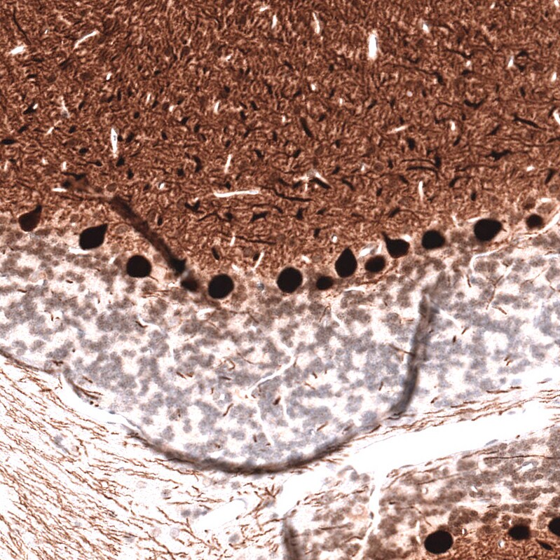 Calbindin D-28K Antibody (CL15060) - Azide and BSA Free Immunohistochemistry-Paraffin: Calbindin D-28K Antibody [NBP3-44159]