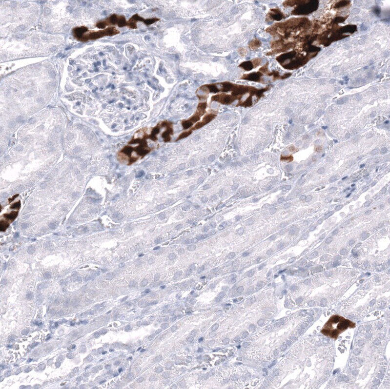 Calbindin D-28K Antibody (CL15059) - Azide and BSA Free Immunohistochemistry-Paraffin: Calbindin D-28K Antibody [NBP3-44160]